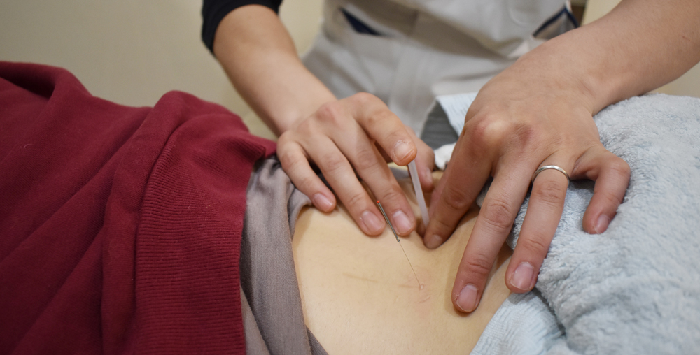 縁和堂　はり治療　接骨院